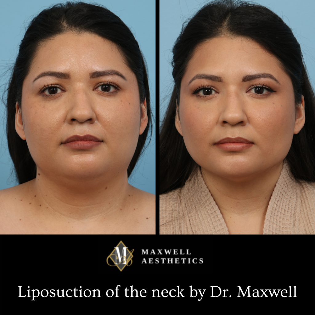 Maxwell Aesthetics | 2490 E River Rd Suite 100, Tucson, AZ 85718, USA | Phone: (520) 751-1225