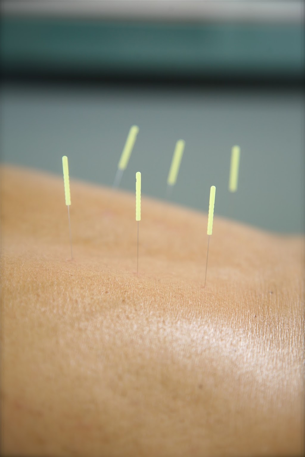 Allyson Nevard, LAc, Good Chi Acupuncture | 321A Boston Post Rd #1, Sudbury, MA 01776, USA | Phone: (508) 740-1424