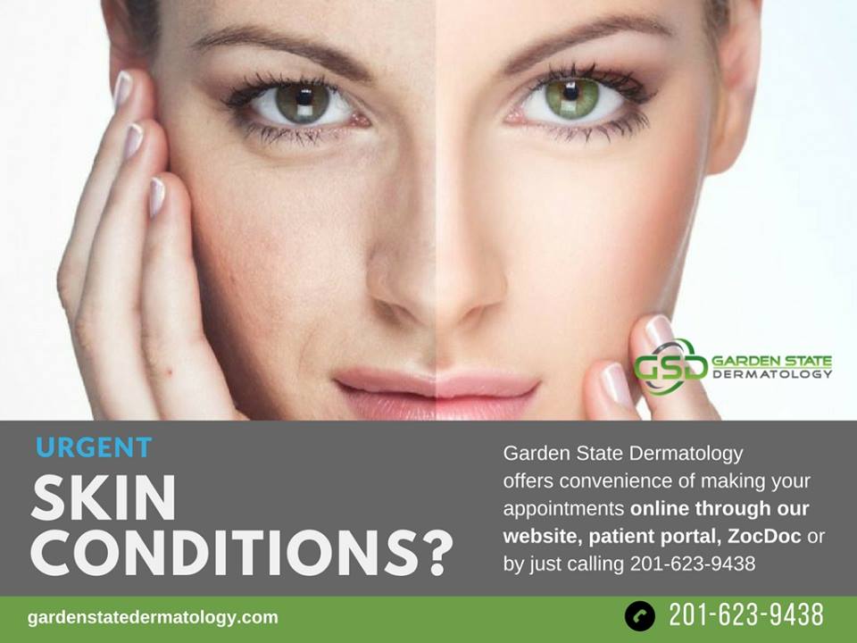 Garden State Dermatology | 150 River Rd STE A2, Montville, NJ 07045, USA | Phone: (201) 623-9438