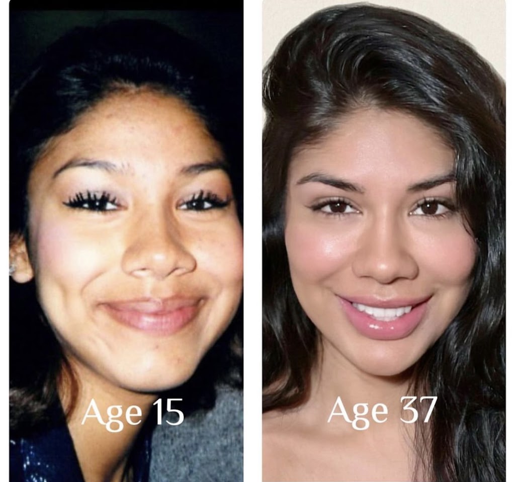 Glow DermSolutions San Jose | 6950 Santa Teresa Blvd STE E, San Jose, CA 95119, USA | Phone: (408) 794-5503 Glow DermSolutions San Jose | 6950 Santa Teresa Blvd STE E, San Jose, CA 95119, USA | Phone: (408) 794-5503