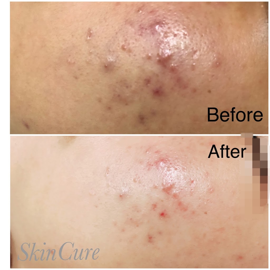 SkinCure K-beauty Spa | 5257 Stevens Creek Blvd, Santa Clara, CA 95051, USA | Phone: (408) 230-9608