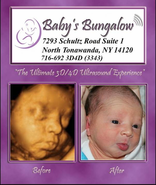 Babys Bungalow 3D & 4D Ultrasound Buffalo NY | 7293 Schultz Rd #1, North Tonawanda, NY 14120, USA | Phone: (716) 444-5555