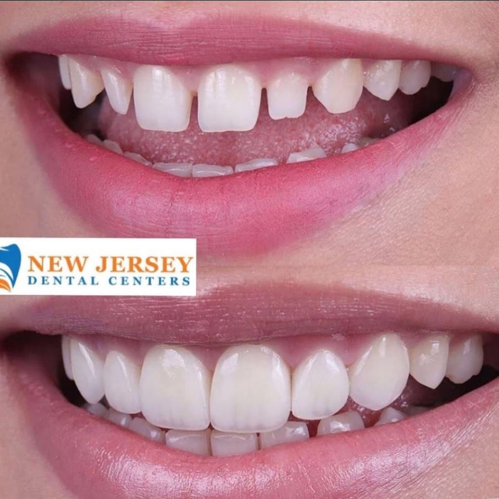 Piscataway Dental Group | 1315 Stelton Rd, Piscataway, NJ 08854, USA | Phone: (732) 985-5600