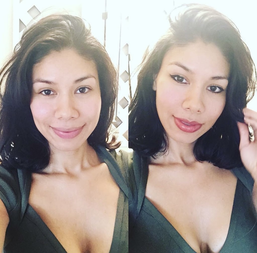 Glow DermSolutions San Jose | 6950 Santa Teresa Blvd STE E, San Jose, CA 95119, USA | Phone: (408) 794-5503 Glow DermSolutions San Jose | 6950 Santa Teresa Blvd STE E, San Jose, CA 95119, USA | Phone: (408) 794-5503