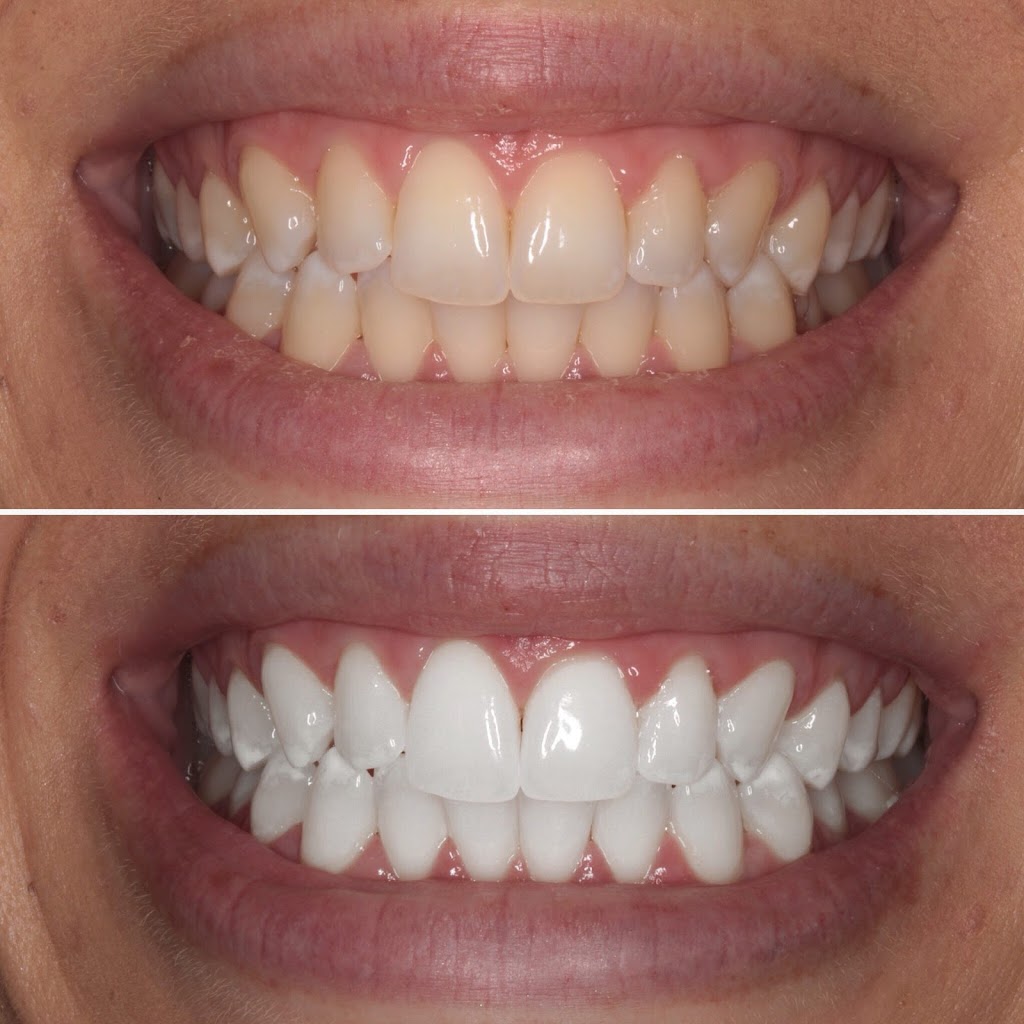 Taiwhitening | 518 Central Ave, Osseo, MN 55369, USA | Phone: (612) 217-2620