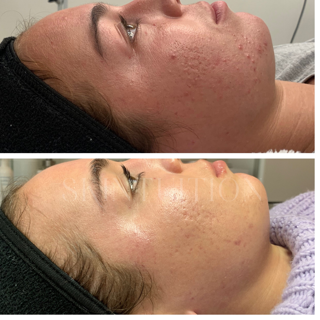 Skintuition | 220 Mt Mercy Dr, Pewee Valley, KY 40056, USA | Phone: (502) 309-5050