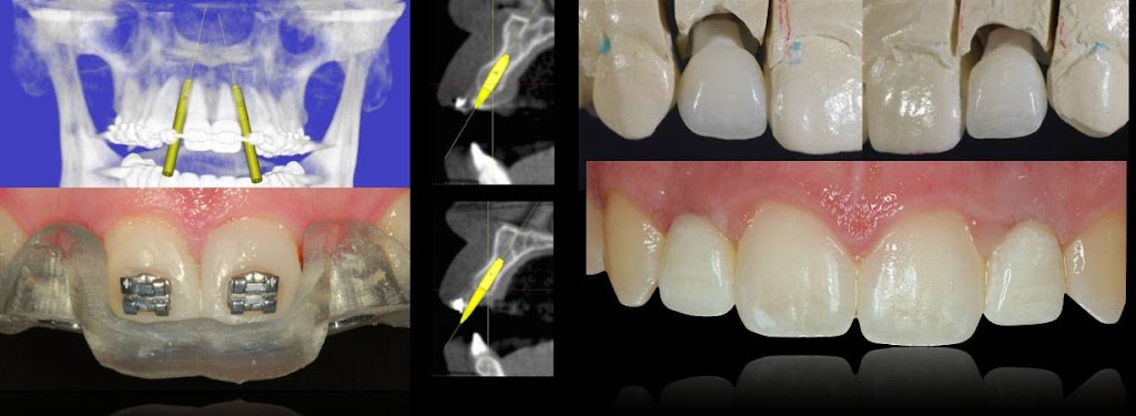 Stafford Prosthodontics | 623 Garrisonville Rd, Stafford, VA 22554, USA | Phone: (540) 300-1248