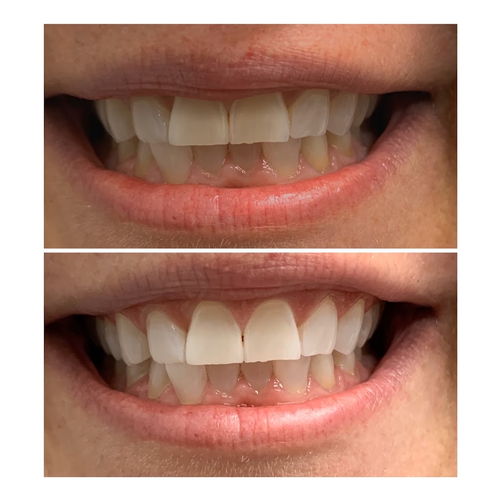 Smile Spa Teeth Whitening | 143 E Germann Rd building 101 suite 404, Gilbert, AZ 85297, USA | Phone: (480) 925-4050