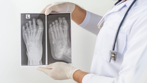 Associated Podiatrists P.C. | 12115 Pacific St, Omaha, NE 68154, USA | Phone: (402) 334-9626