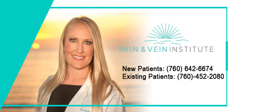 Skin & Vein Institute | 477 N El Camino Real Suite D304, Encinitas, CA 92024, United States | Phone: (760) 642-6674