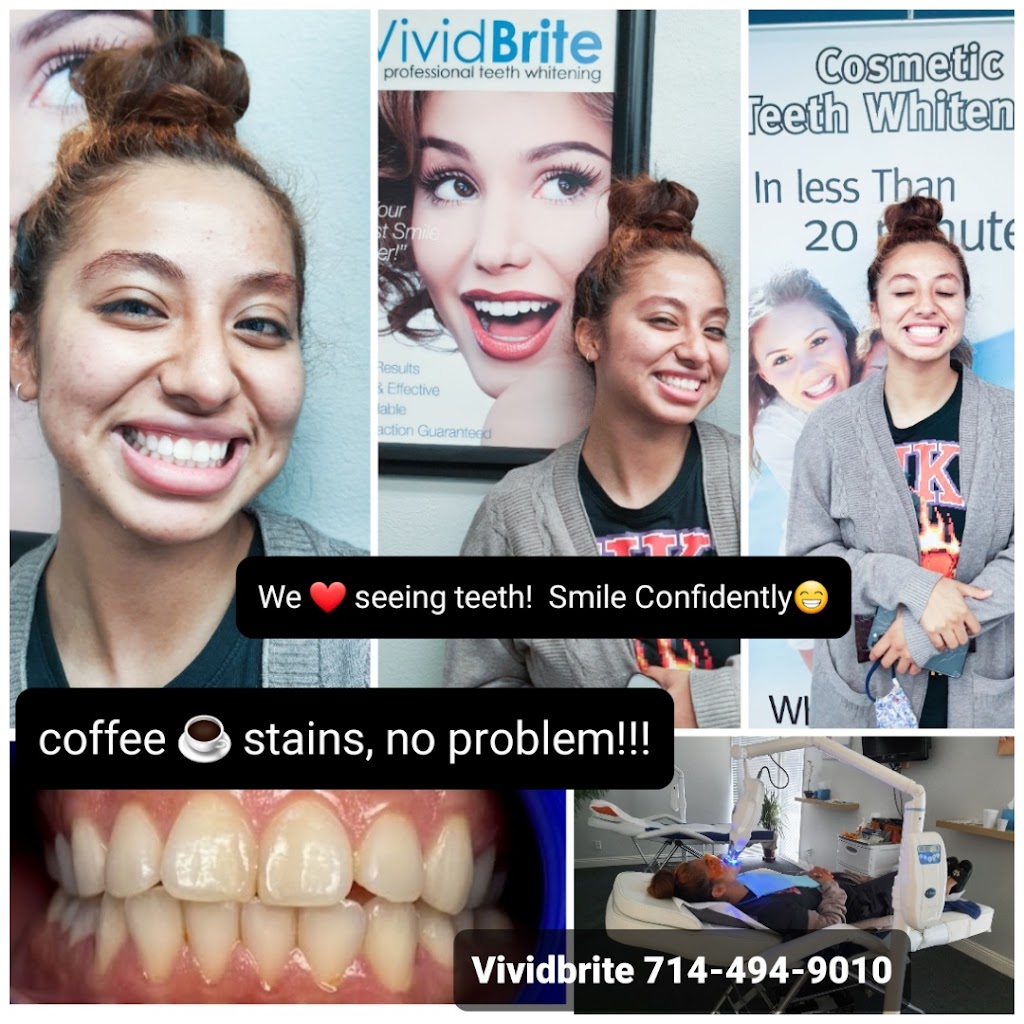 VividBrite Express Teeth Whitening starts $99 | 2510 N Grand Ave #201, Santa Ana, CA 92705, USA | Phone: (714) 494-9010