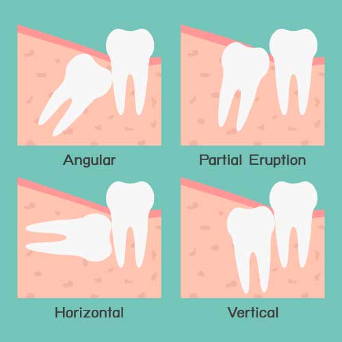 Carolina Oral & Maxillofacial Surgery | 105 Ben Casey Dr #115, Fort Mill, SC 29708, USA | Phone: (803) 548-9910