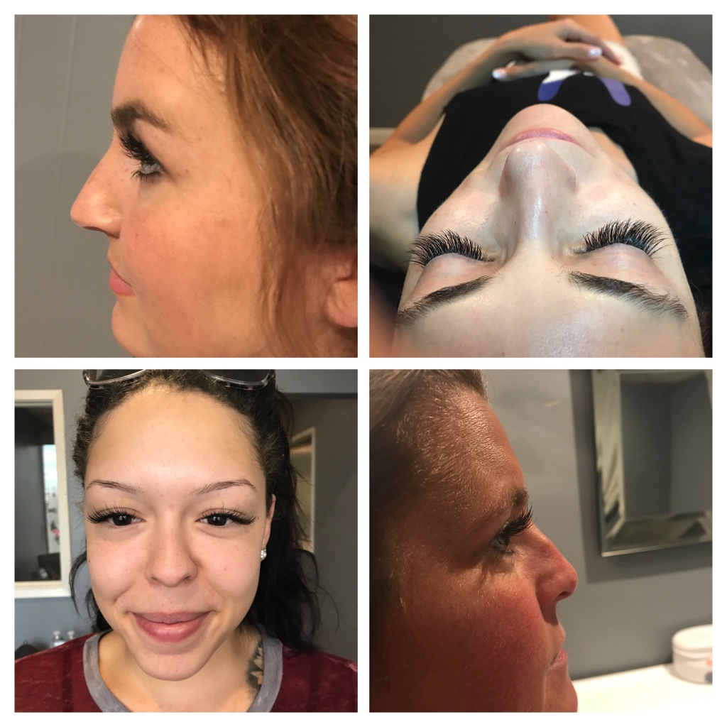 Bare Skin Beauty | 985 W Foothill Blvd # C, Claremont, CA 91711, USA | Phone: (909) 621-2218