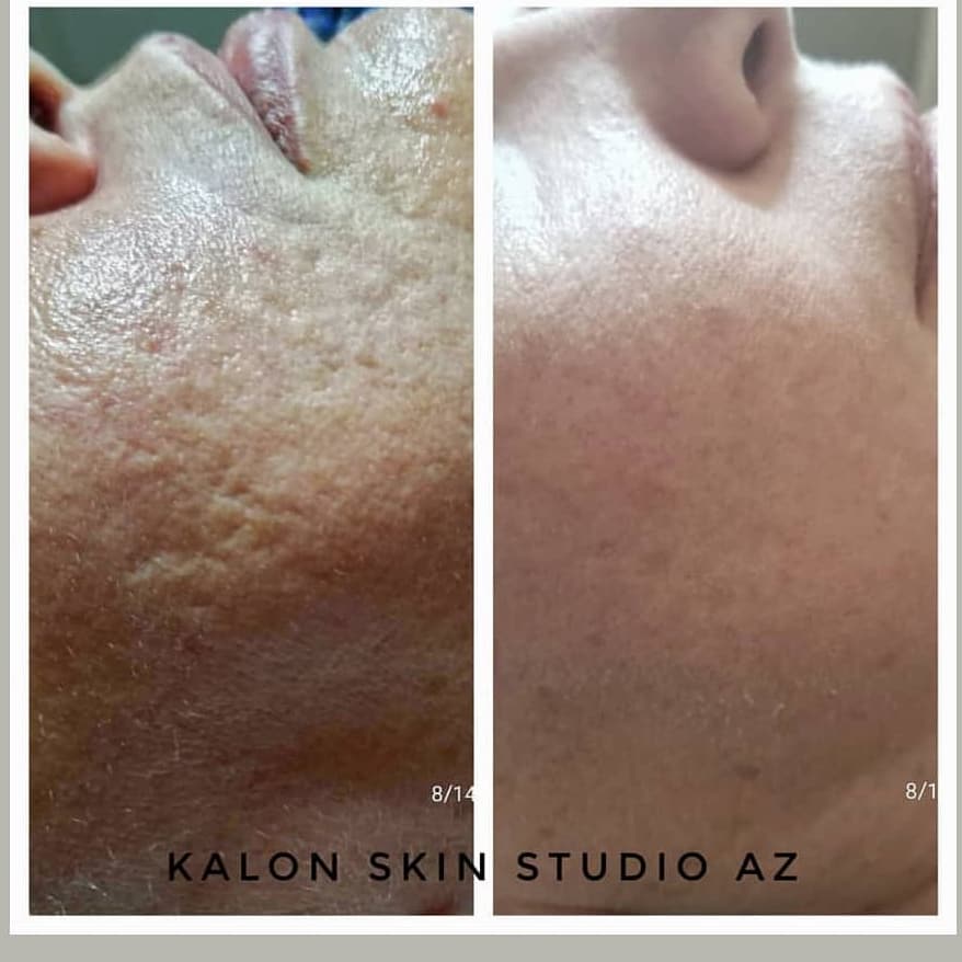Kalon skin studio | 6318 S Higley Rd Suite 102, Gilbert, AZ 85298, USA | Phone: (480) 593-1564