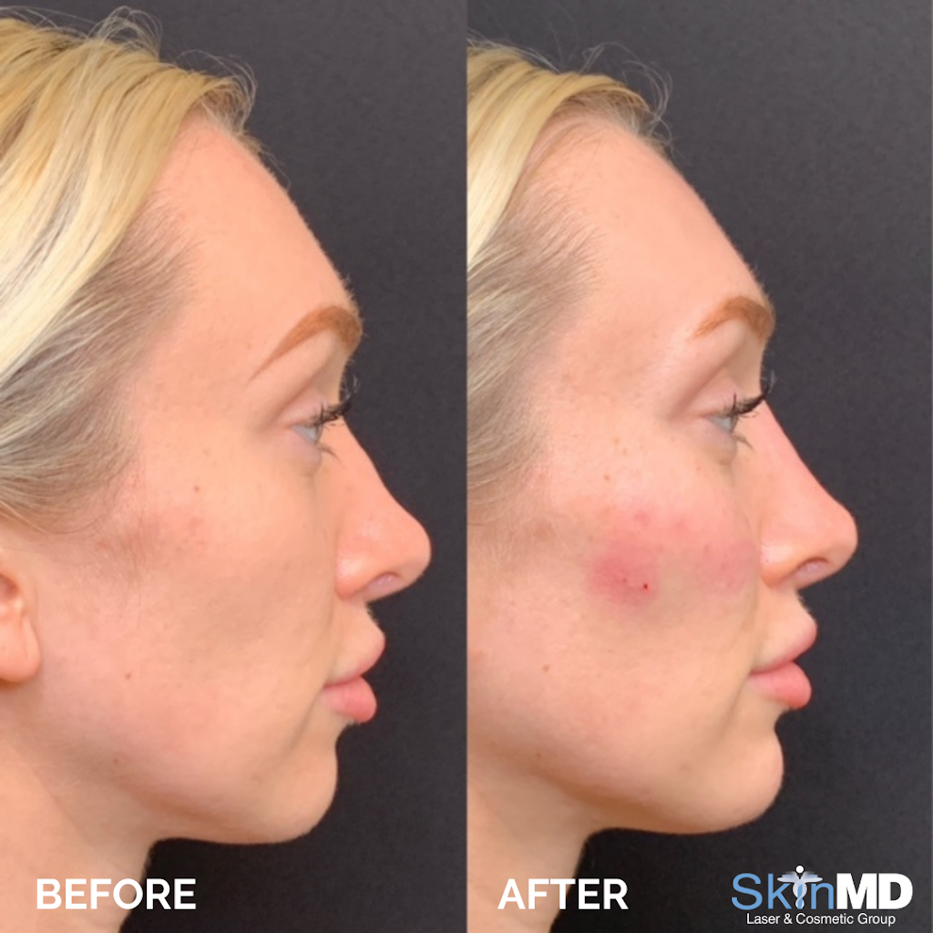 Skin MD Norwell | 400 Washington St, Norwell, MA 02061, USA | Phone: (781) 659-4900