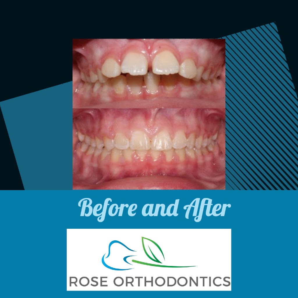 Rose Orthodontics: Aaron Rose, DMD, MS | 980 W Central Ave Suite D, Delaware, OH 43015, USA | Phone: (740) 272-4455