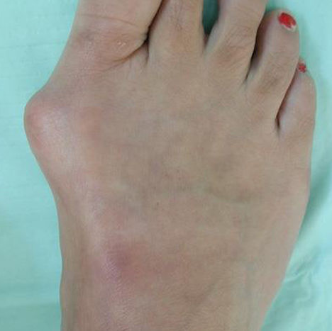 Larry Best, DPM | 400 1/2, Union St, LaGrange, IN 46761, USA | Phone: (260) 499-0888