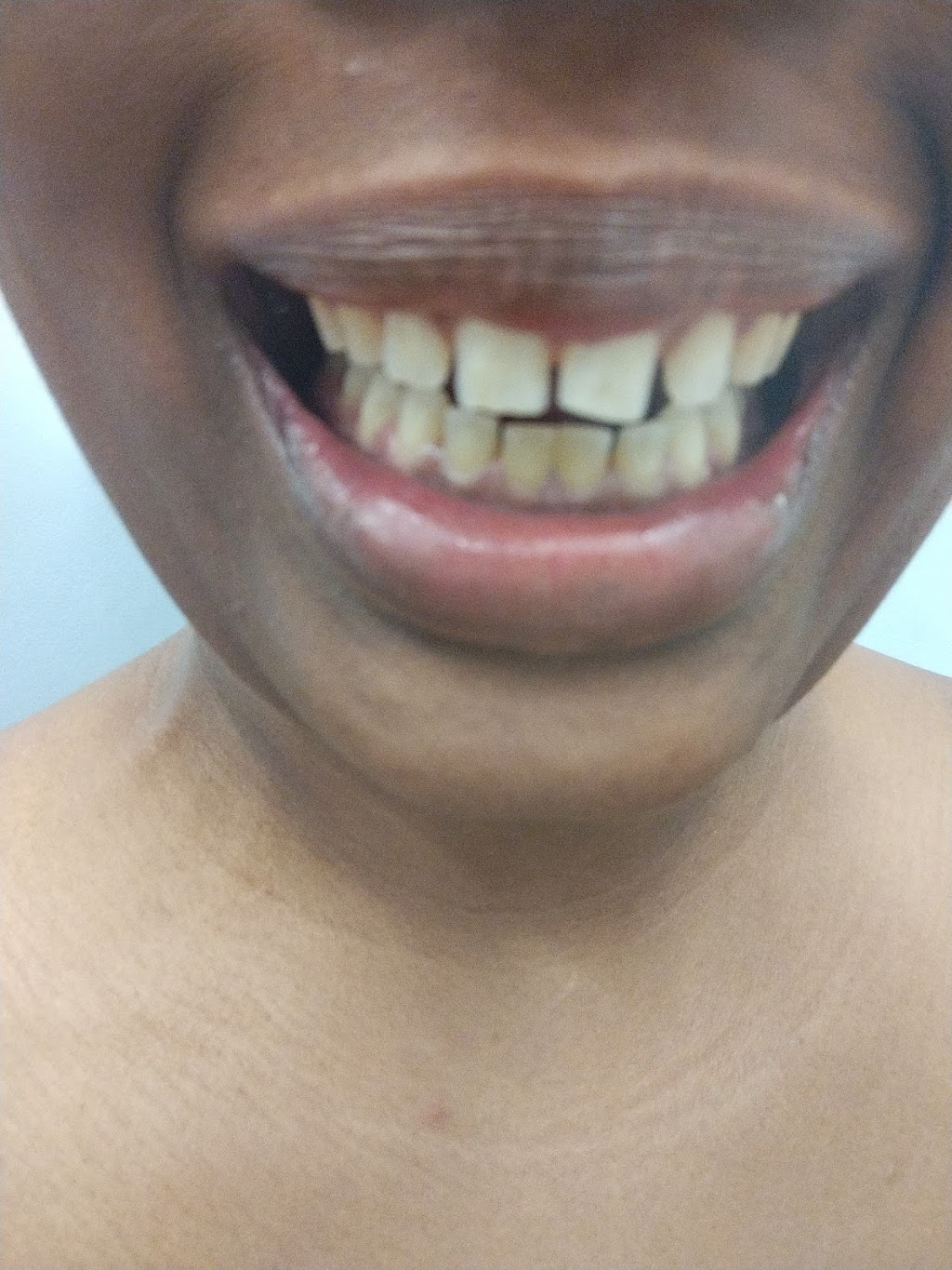 My Tooth Docs | 16240 Louis Ave, South Holland, IL 60473, USA | Phone: (708) 333-2909