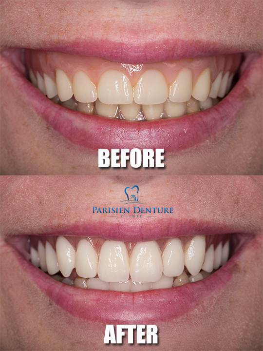 Parisien Denture Clinic | 375 Cabana Rd E, Windsor, ON N9G 1A1, Canada | Phone: (519) 997-7799