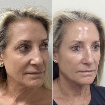 Rejuvenate & Wellness Center Lakeland | 4019 US Hwy 98 N Suite 124, Lakeland, FL 33809, USA | Phone: (321) 294-3586