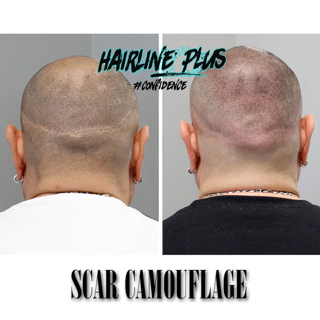 Hairline Plus | 1050 Stuyvesant Ave, Union, NJ 07083, USA | Phone: (908) 318-4018