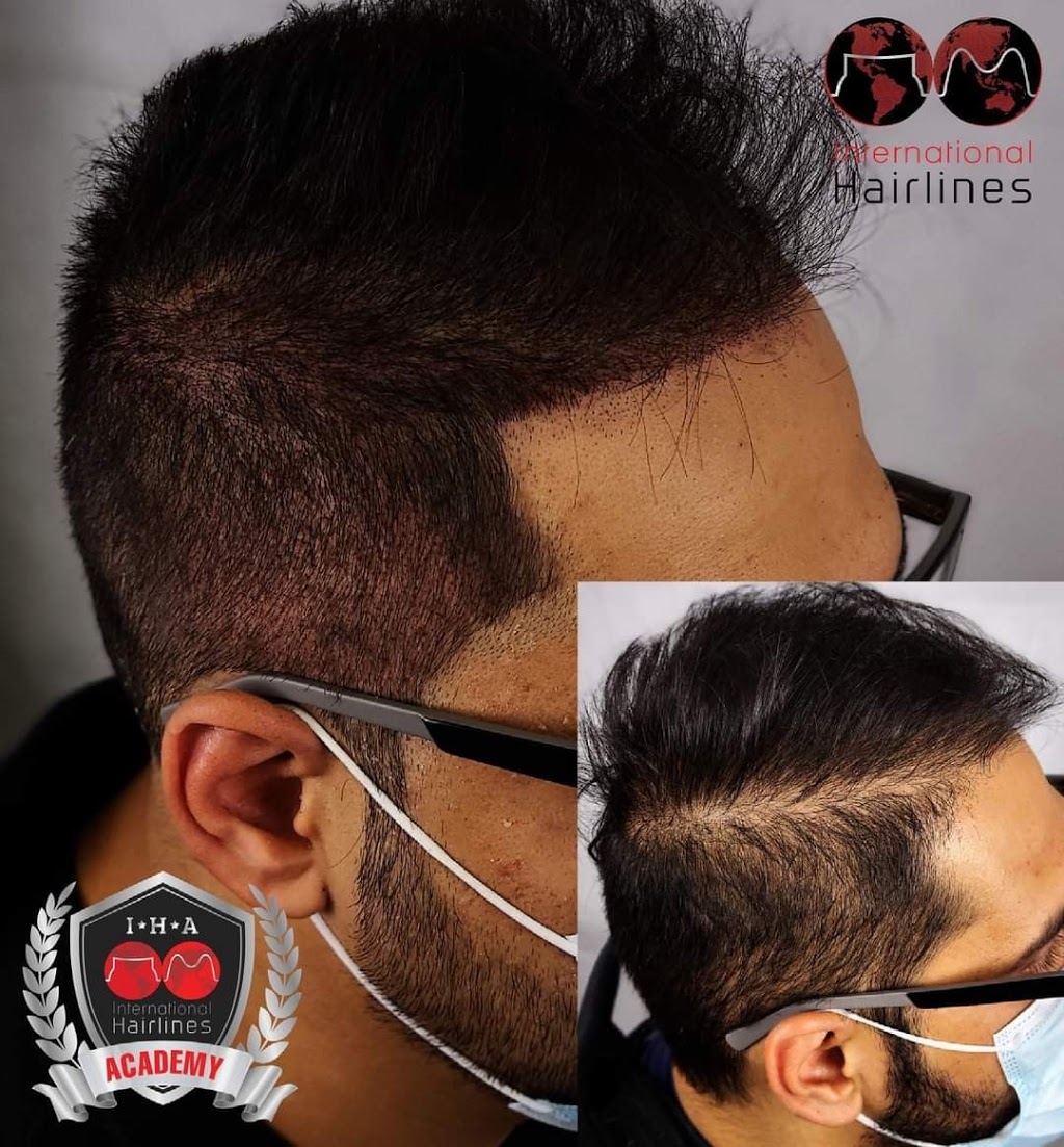 Pittsburgh International Hairlines | 2001 Montour Church Rd Second Floor, Oakdale, PA 15071 | Phone: (877) 567-3709