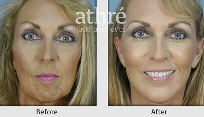 Athré Facial Plastics | 2121 Sage Rd #245, Houston, TX 77056, United States | Phone: (281) 557-3223