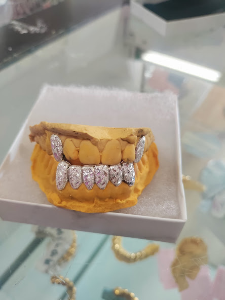 The Plug Custom Grillz | 3701 NW 9th Ave #3, Pompano Beach, FL 33064 | Phone: (561) 860-1364