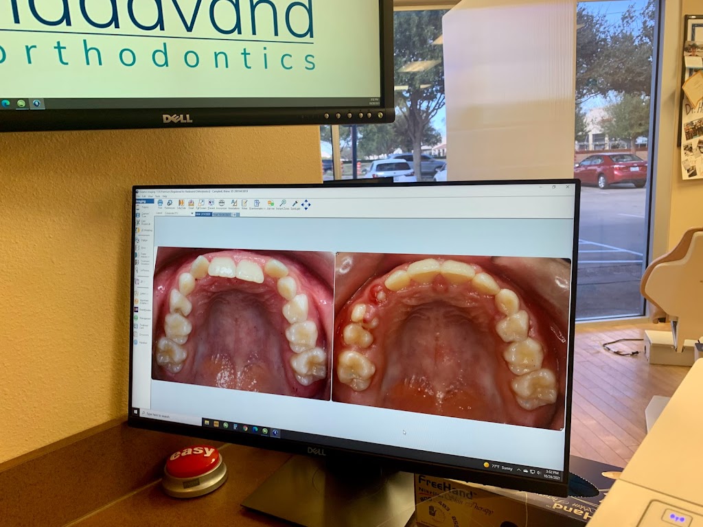 Hadavand Orthodontics | 8901 Virginia Pkwy STE 800, McKinney, TX 75071, USA | Phone: (972) 540-2121