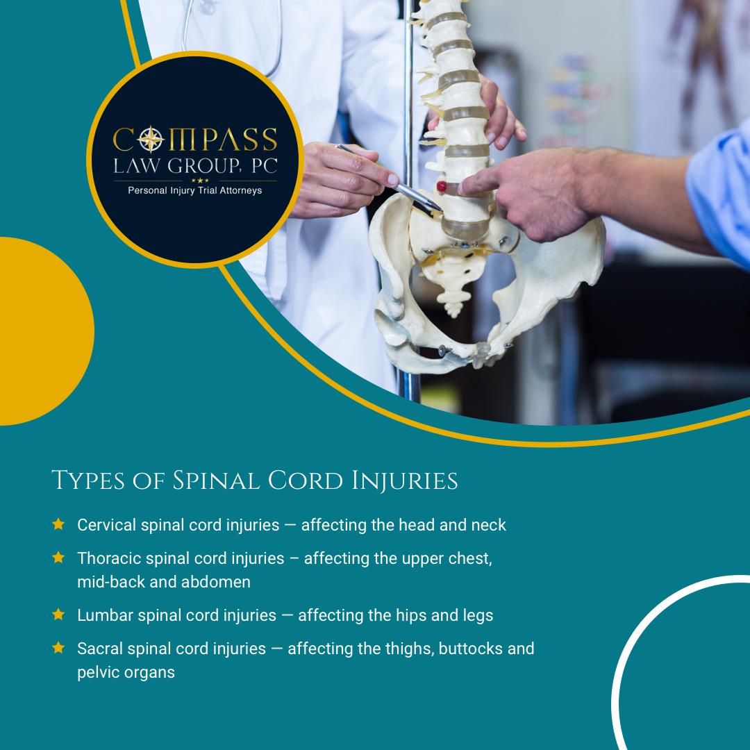 Compass Law Group LLP Injury and Accident Attorneys | 8665 Wilshire Blvd #302, Beverly Hills, CA 90211, United States | Phone: (310) 289-7126