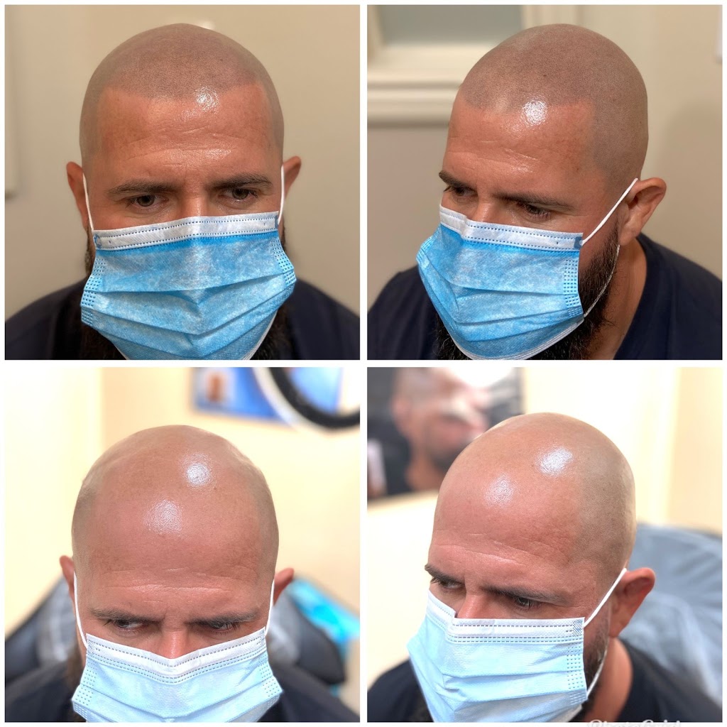 Skalp | Los Angeles Scalp Micropigmentation Clinic | 6735 Westminster Blvd. Suite 105, Westminster, CA 92683, USA | Phone: (323) 400-3595