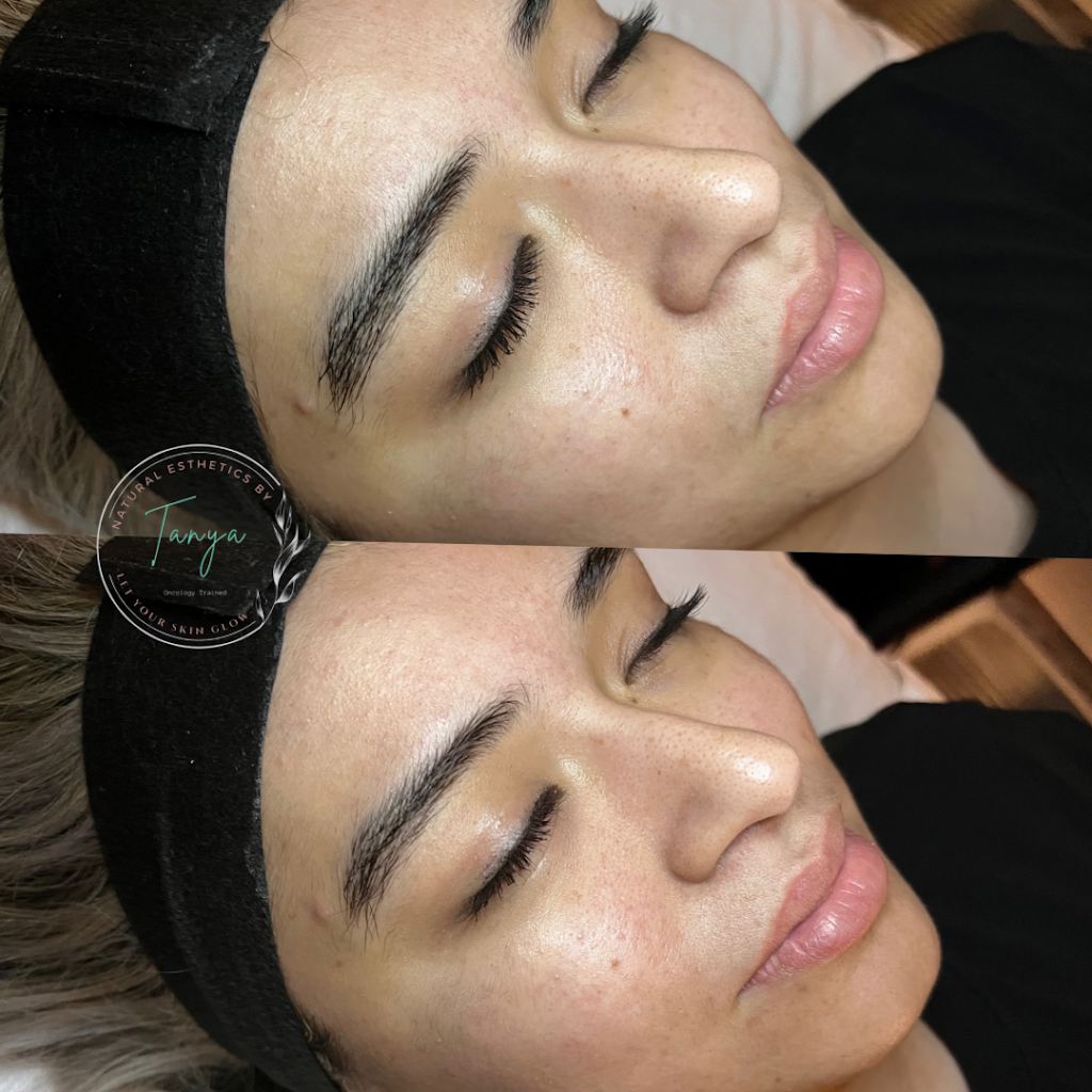 Natural Esthetics by Tanya | 110 Panorama Loop Suite F, Waxahachie, TX 75165, USA | Phone: (214) 949-5060