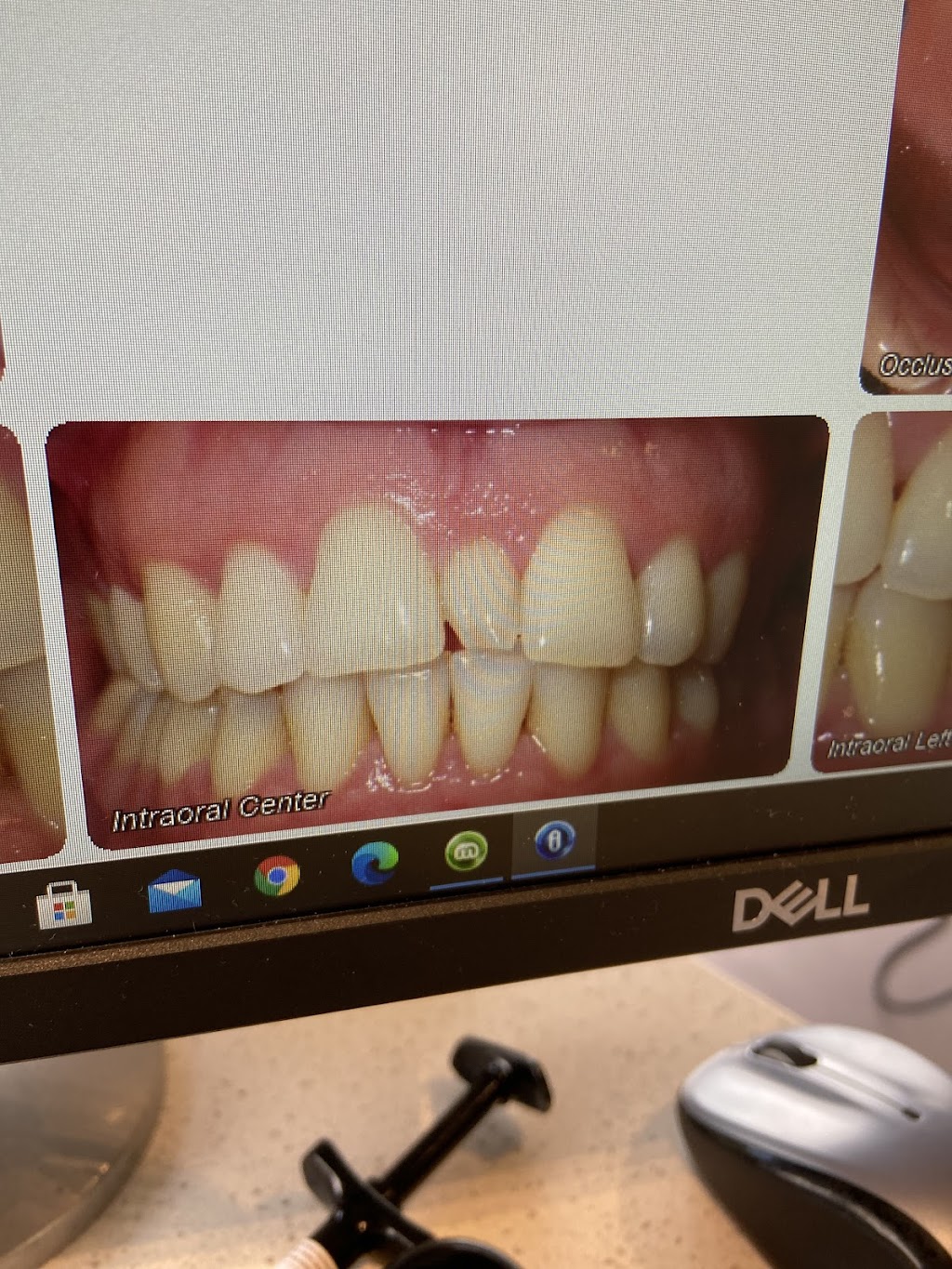 Perfect Smiles Orthodontics | 6303 Little River Turnpike #200, Alexandria, VA 22312 | Phone: (703) 750-0147