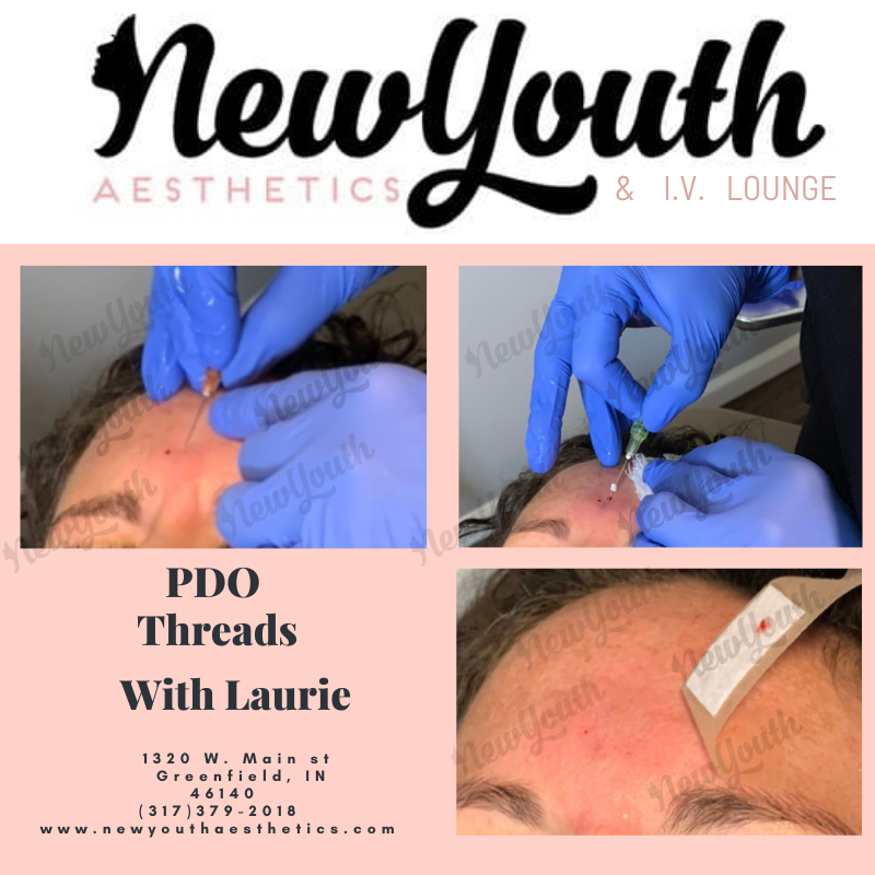 New Youth Aesthetics | 1320 W Main St, Greenfield, IN 46140, USA | Phone: (317) 379-2018