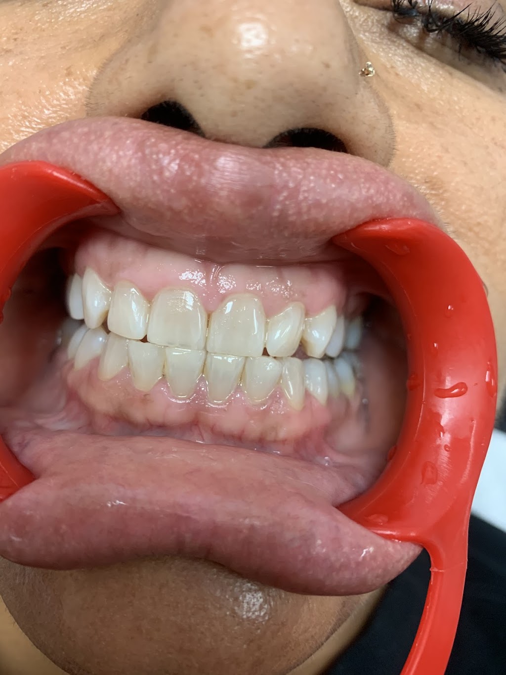 Beauty and Body | 1115 Via Verde, San Dimas, CA 91773, USA | Phone: (626) 838-6908