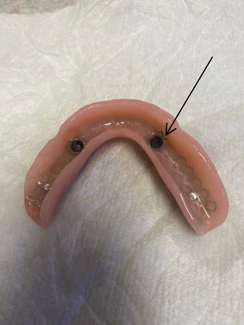 Martigon Dental Lab | 12684 Atherton Dr, Moreno Valley, CA 92555, USA | Phone: (951) 247-3459