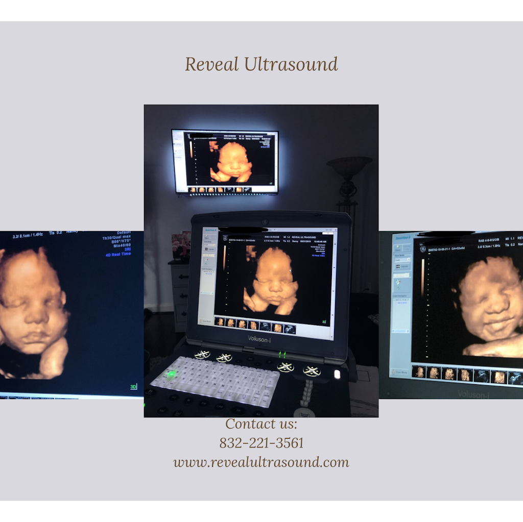 Reveal Ultrasound | 5211 Pilgrim Oaks Ln, League City, TX 77573, USA | Phone: (832) 221-3561