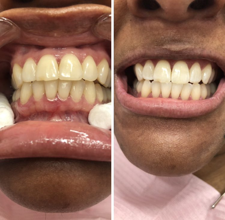 Snow White Teeth Services LLC | 11720 Beltsville Dr Suite 500, Beltsville, MD 20705, USA | Phone: (202) 213-6062