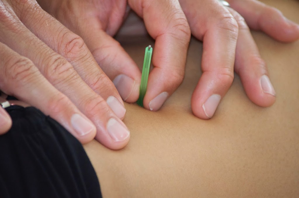 Mill-e-Moto: Acupuncture | 12005 SW 70th Ave, Tigard, OR 97223, USA | Phone: (503) 372-6463