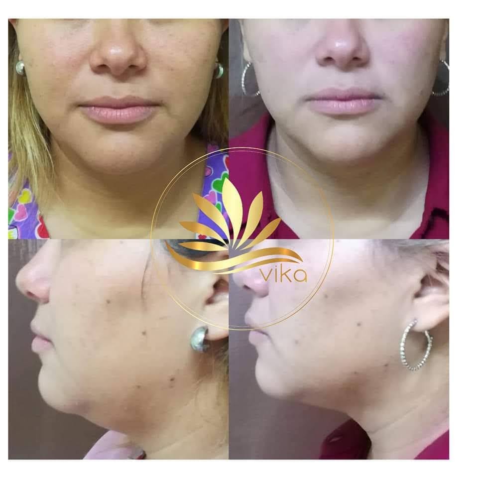 ViKa Medicina y Nutrición | C. Simona Barba 5110, 32354 Cd Juárez, Chih., Mexico | Phone: 656 107 3132