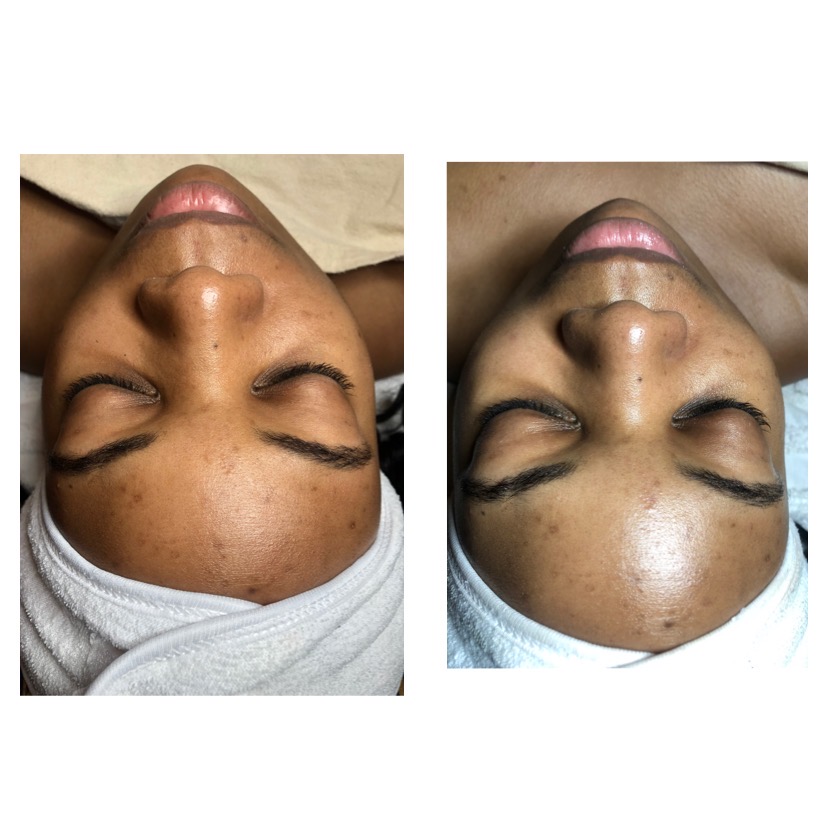 SkinDividual Skincare Studio | Carlisle Ave, Baltimore, MD 21216, USA | Phone: (443) 780-4808