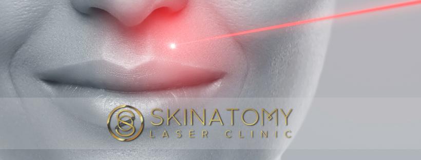 Skinatomy Laser Clinic | 4092 Confederation Pkwy, Mississauga, ON L5B 0G4, Canada | Phone: (905) 949-9198