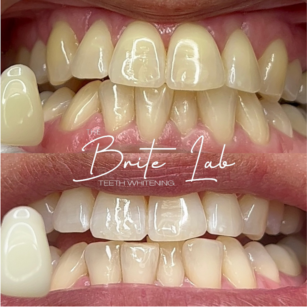 The Brite Lab Teeth Whitening | 22597 Barton Rd Ste. D, Grand Terrace, CA 92313, USA | Phone: (909) 566-1340