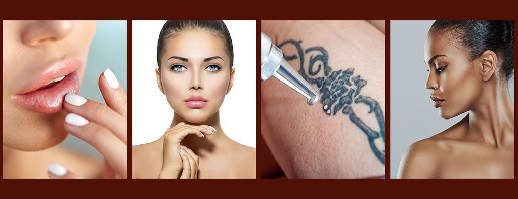 RW Aesthetics - Tattoo Removal and Weight Loss | 8231 Rochester Ave suite c, Rancho Cucamonga, CA 91730, USA | Phone: (909) 372-5755