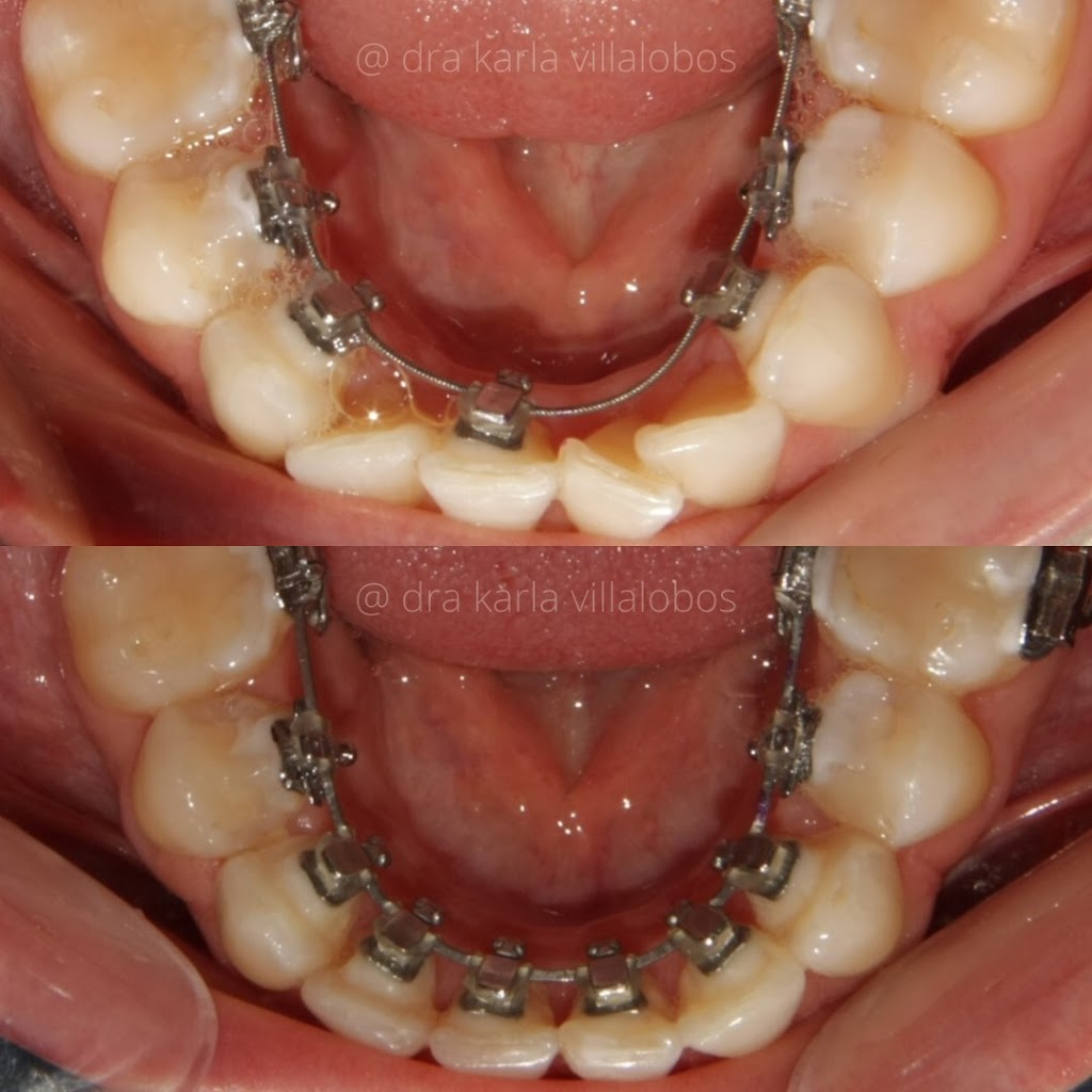 Implantes dentales en Tijuana - DENTOK México | Diego Rivera 2311-Int. 404, Zona Urbana Rio Tijuana, 22010 Tijuana, B.C., Mexico | Phone: 664 630 5194