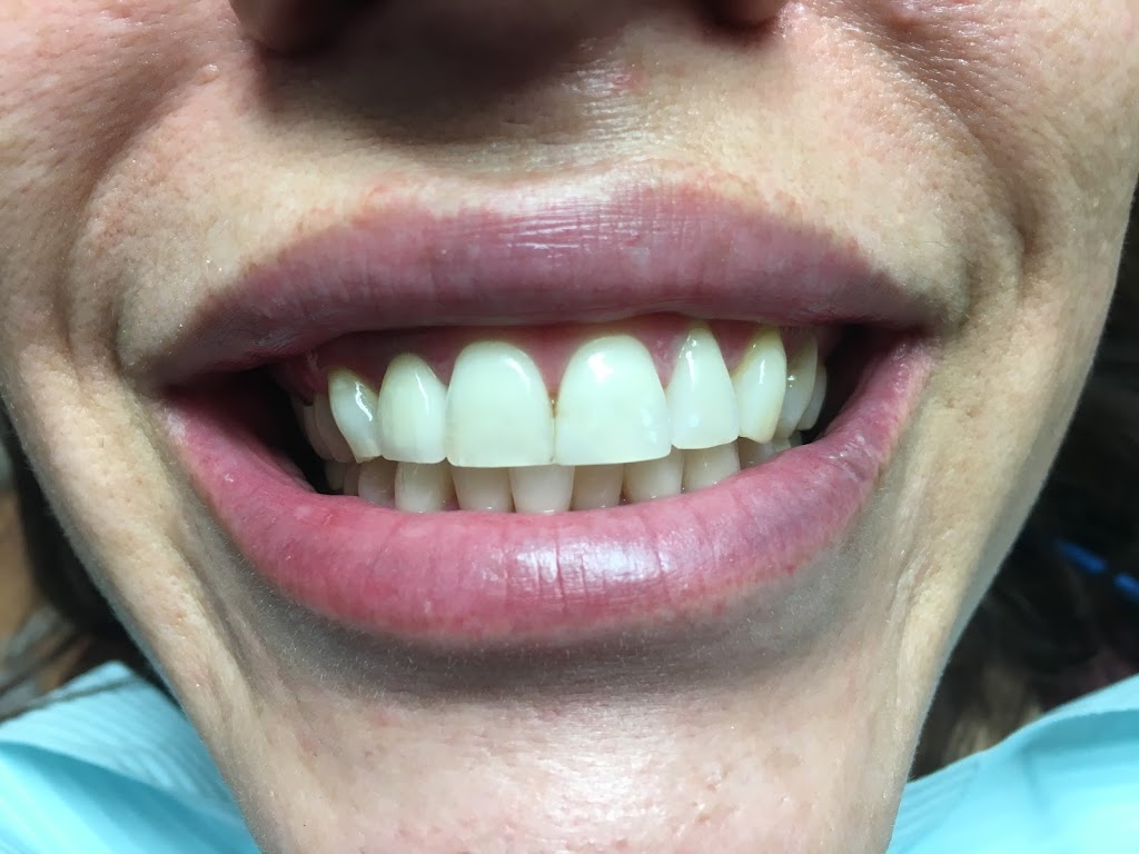Custom Dental Arts | 2927 Salvio St, Concord, CA 94519, USA | Phone: (925) 285-9555