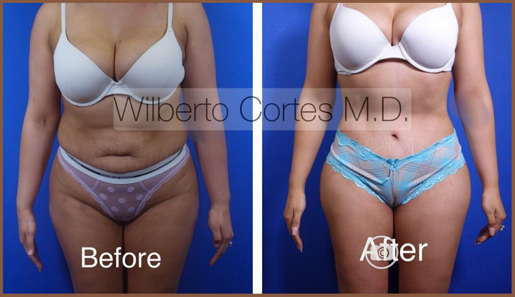 Wilberto Cortes M.D. | 12721 Sawmill Rd, The Woodlands, TX 77380, USA | Phone: (713) 636-2729