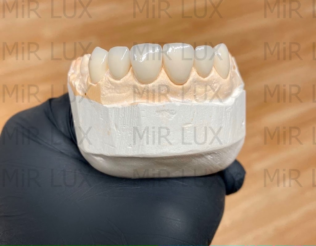 Mir Lux Dental Lab | 4 E Bristol Rd STE B, Feasterville-Trevose, PA 19053, USA | Phone: (215) 850-8680