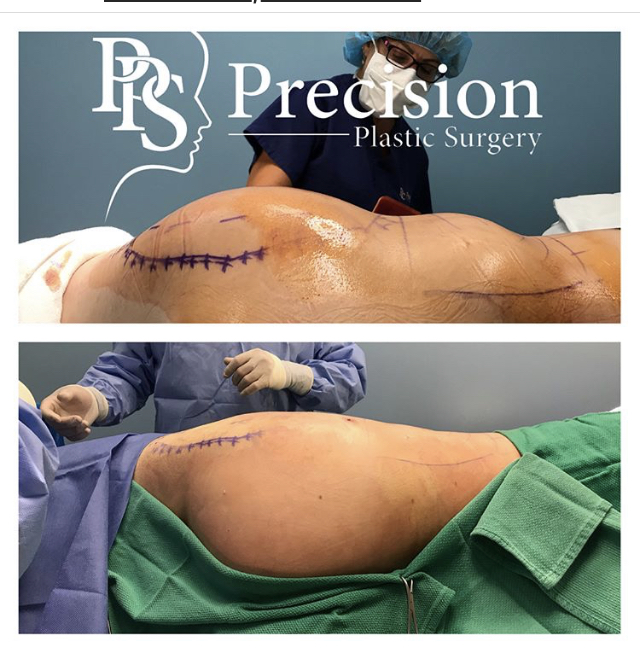 Precision Plastic Surgery: Joseph Ku, MD | 4234 Riverwalk Pkwy #170, Riverside, CA 92505, USA | Phone: (951) 509-9204