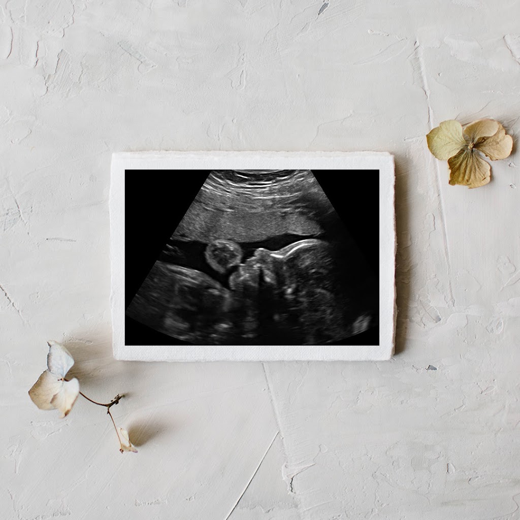 White Stork & Co. 3D 4D HD Ultrasound Imaging & Photography Studio | 1982 Providence Pkwy Suite 254, Mt. Juliet, TN 37122, USA | Phone: (615) 753-1889